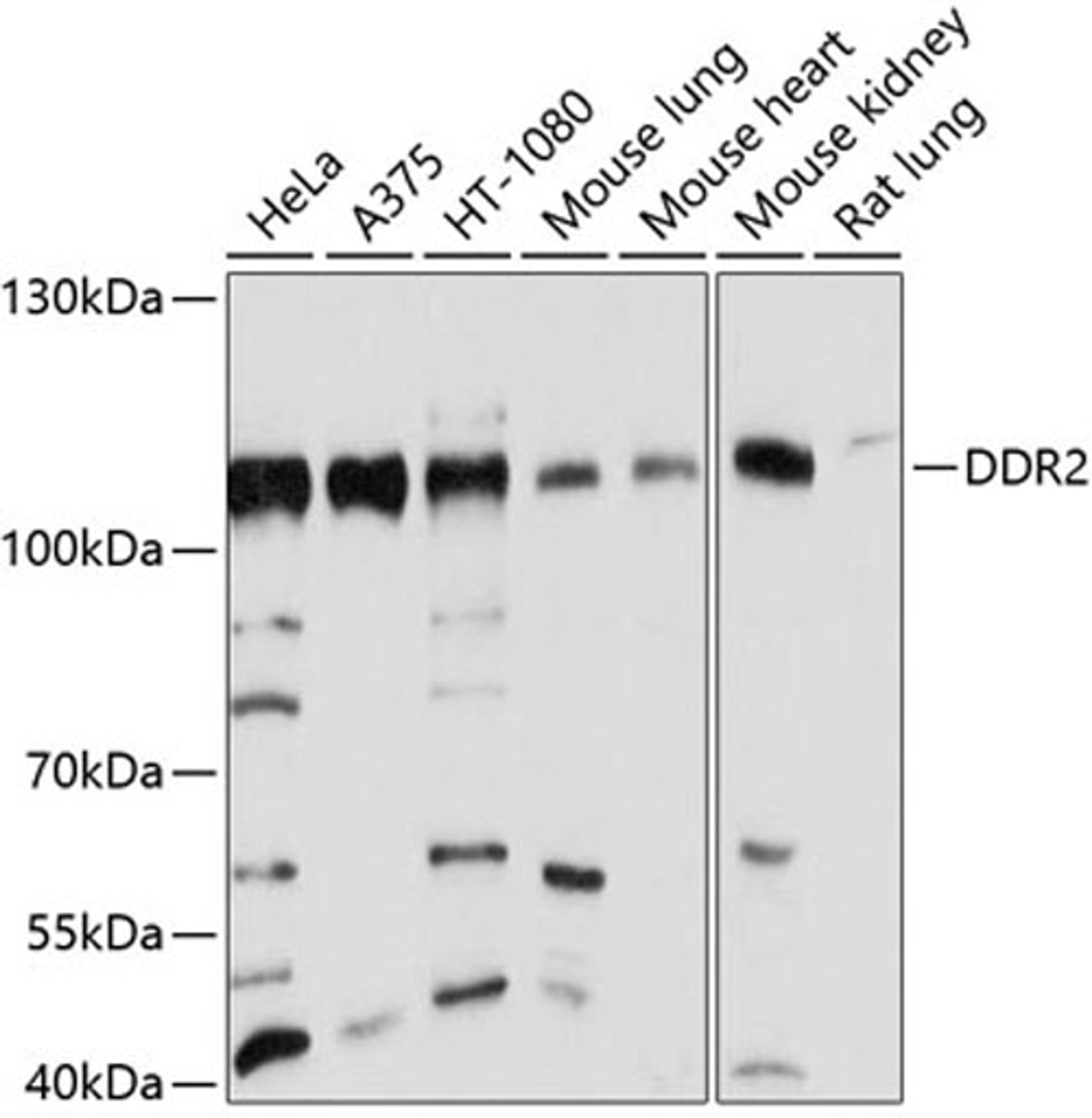 Western blot - DDR2 antibody (A10060)