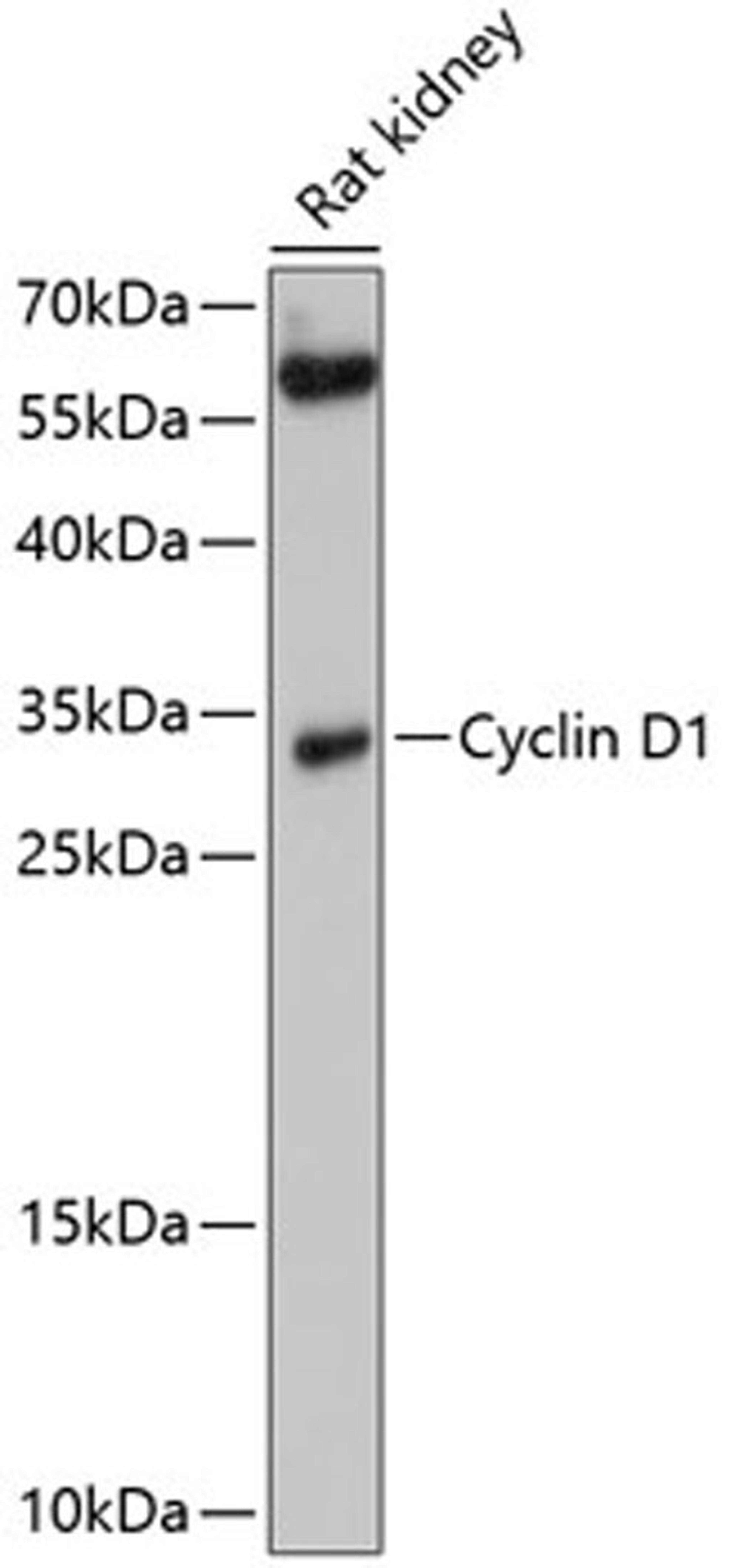 Western blot - Cyclin D1 antibody (A0310)