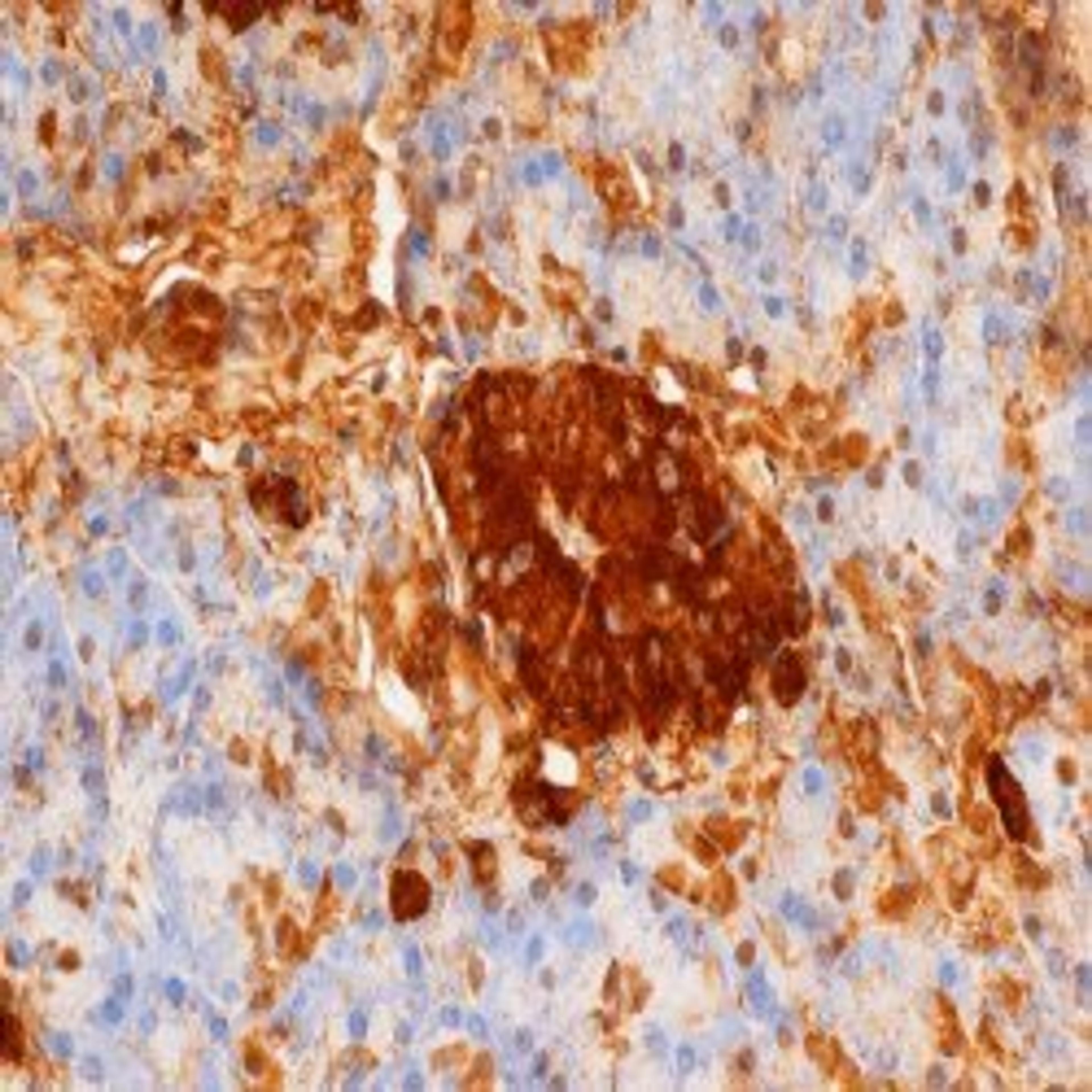 Staining of paraffin embedded human pancreas with Mouse anti Rat Insulin (5330-3369)