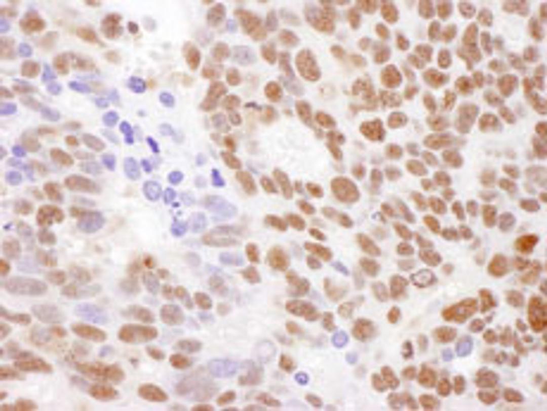 Detection of human RecQ1 by immunohistochemistry.