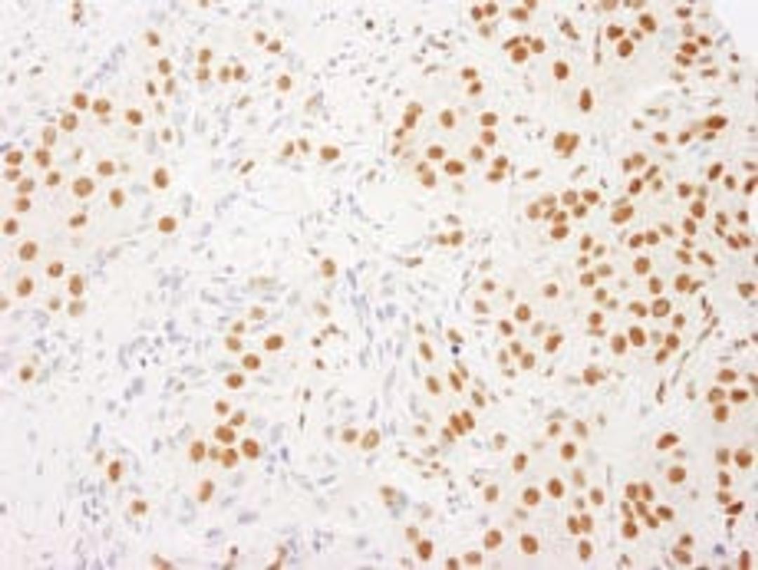 Detection of human RALY by immunohistochemistry.