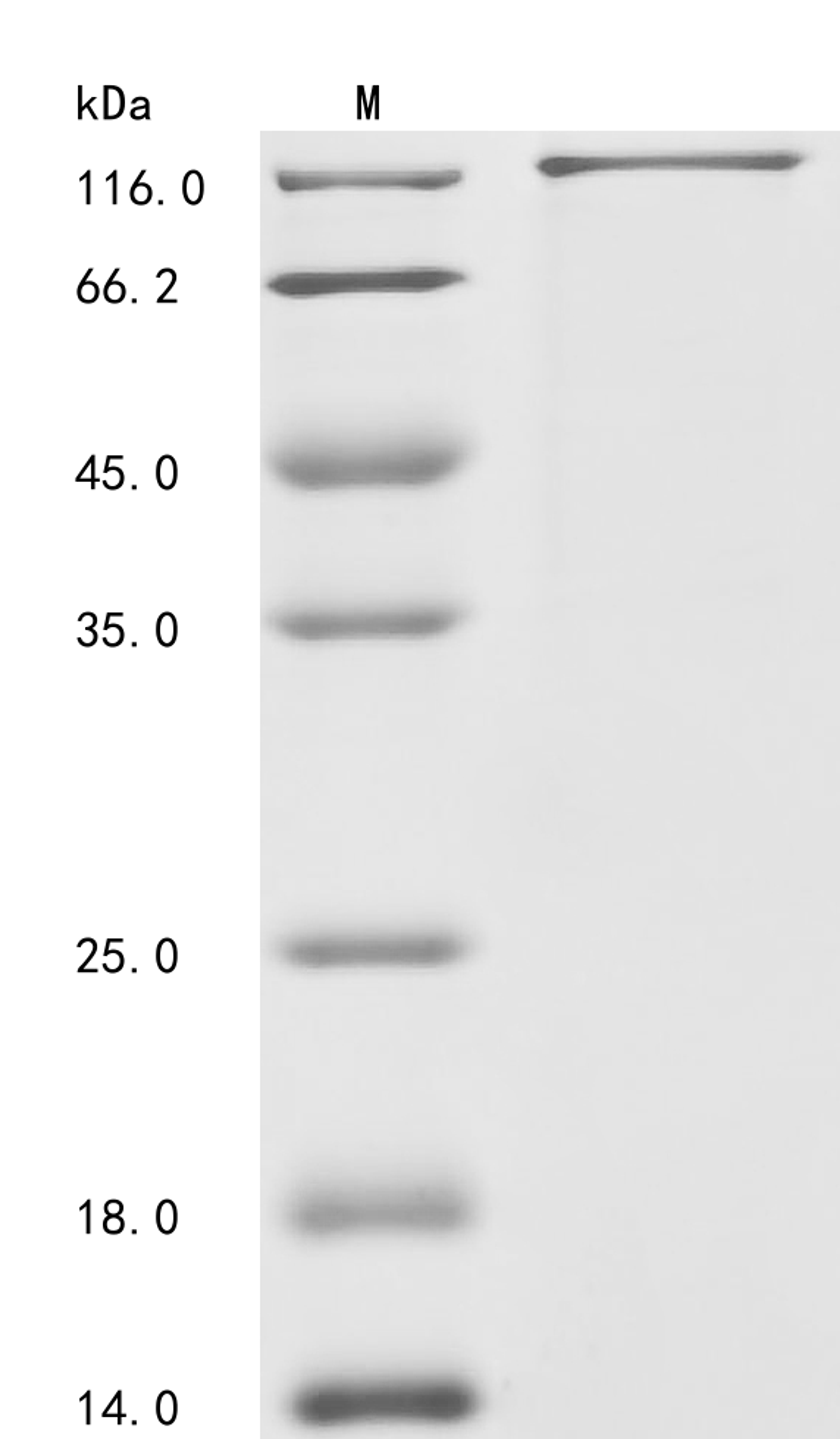 (Tris-Glycine gel) Discontinuous SDS-PAGE (reduced) with 5% enrichment gel and 15% separation gel.