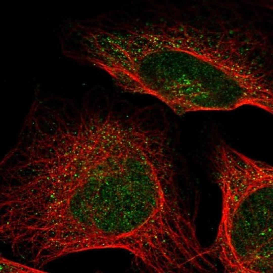 Immunocytochemistry/Immunofluorescence: FAM169A Antibody [NBP1-93616] - Staining of human cell line U-2 OS shows positivity in nuclear membrane & cytoplasm.