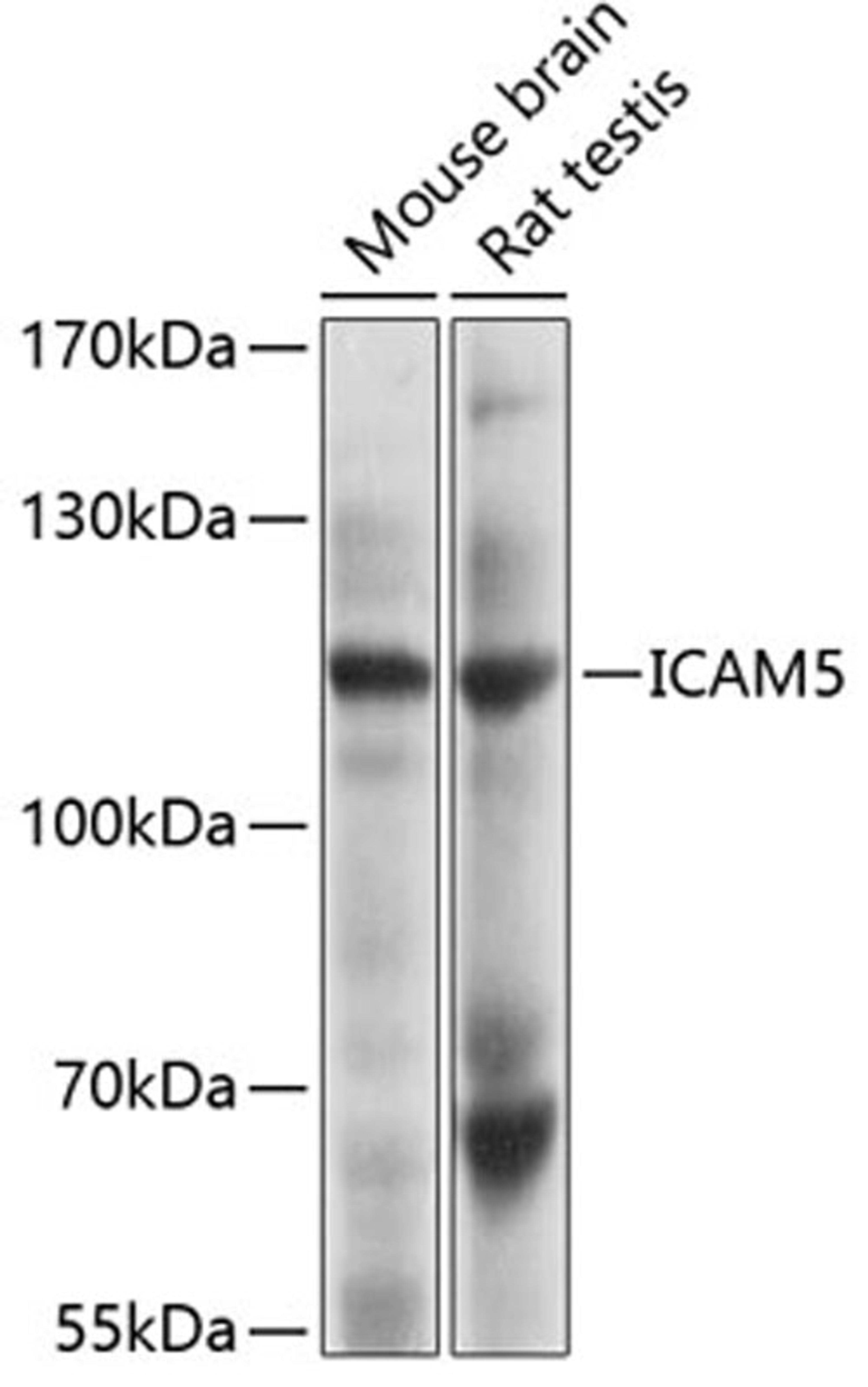 Western blot - ICAM5 Antibody (A4156)