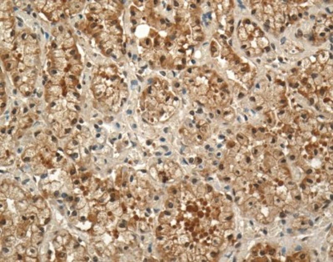 Immunohistochemistry: Prolactin R Antibody (U5) [NB300-561] - Mammary gland tissue from lactating light horse mare (equine) was incubated in anti-prolactin receptor monoclonal mouse antibody at 1:100 for 1 hour at 23C and for 24 hours at 4C. Second antibody was biotinylated goat anti-mouse IgG at 23C for 1 hour. Development using avidin-biotin complex 23C for 1 hour plus 3,3-diaminobenzadine for 15 min and counterstained with haematoxylin.