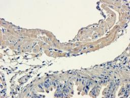 IHC-P image of mouse lung tissue using anti-Sclerostin (2.5 ug/ml)