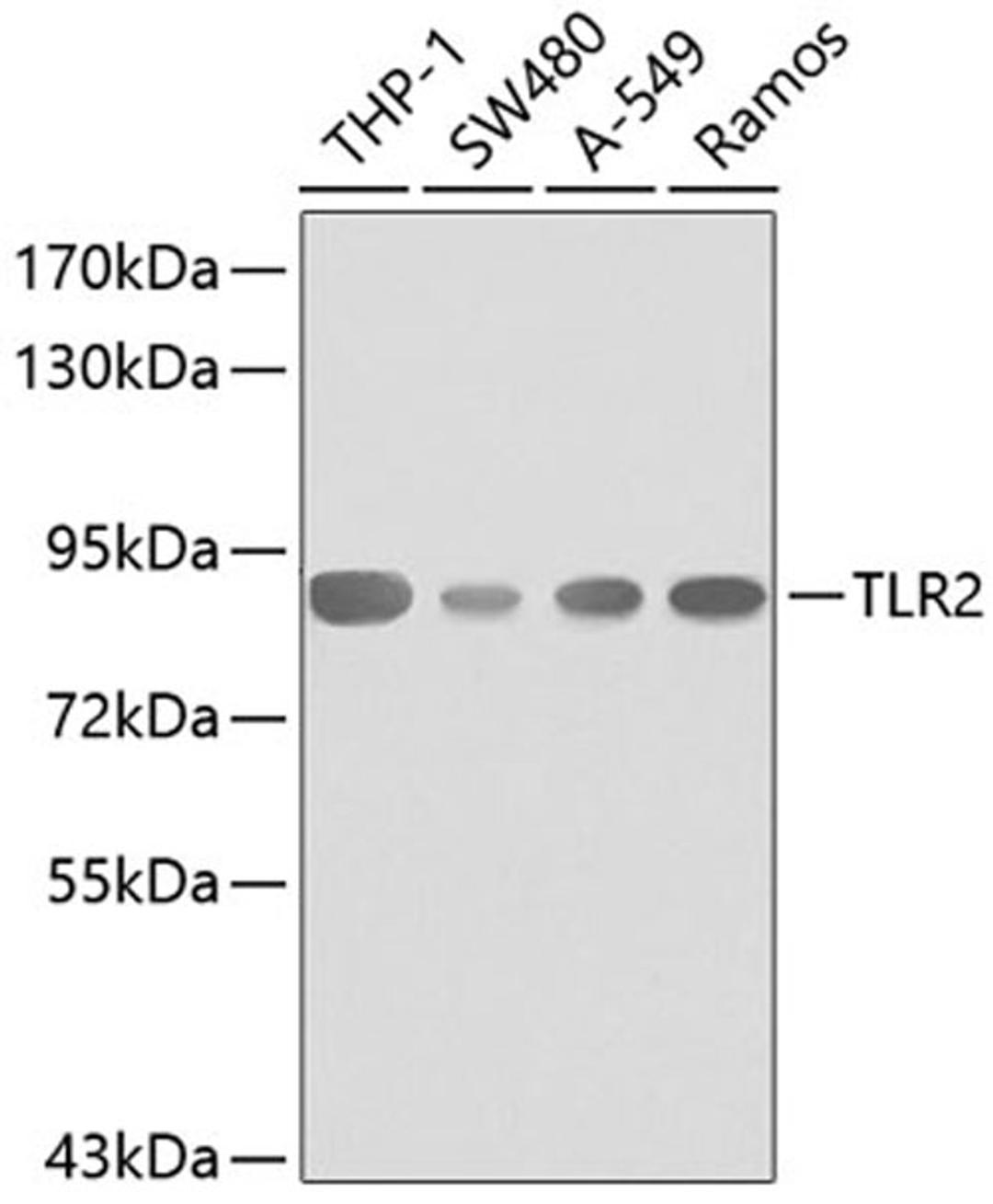 Western blot - TLR2 antibody (A0367)