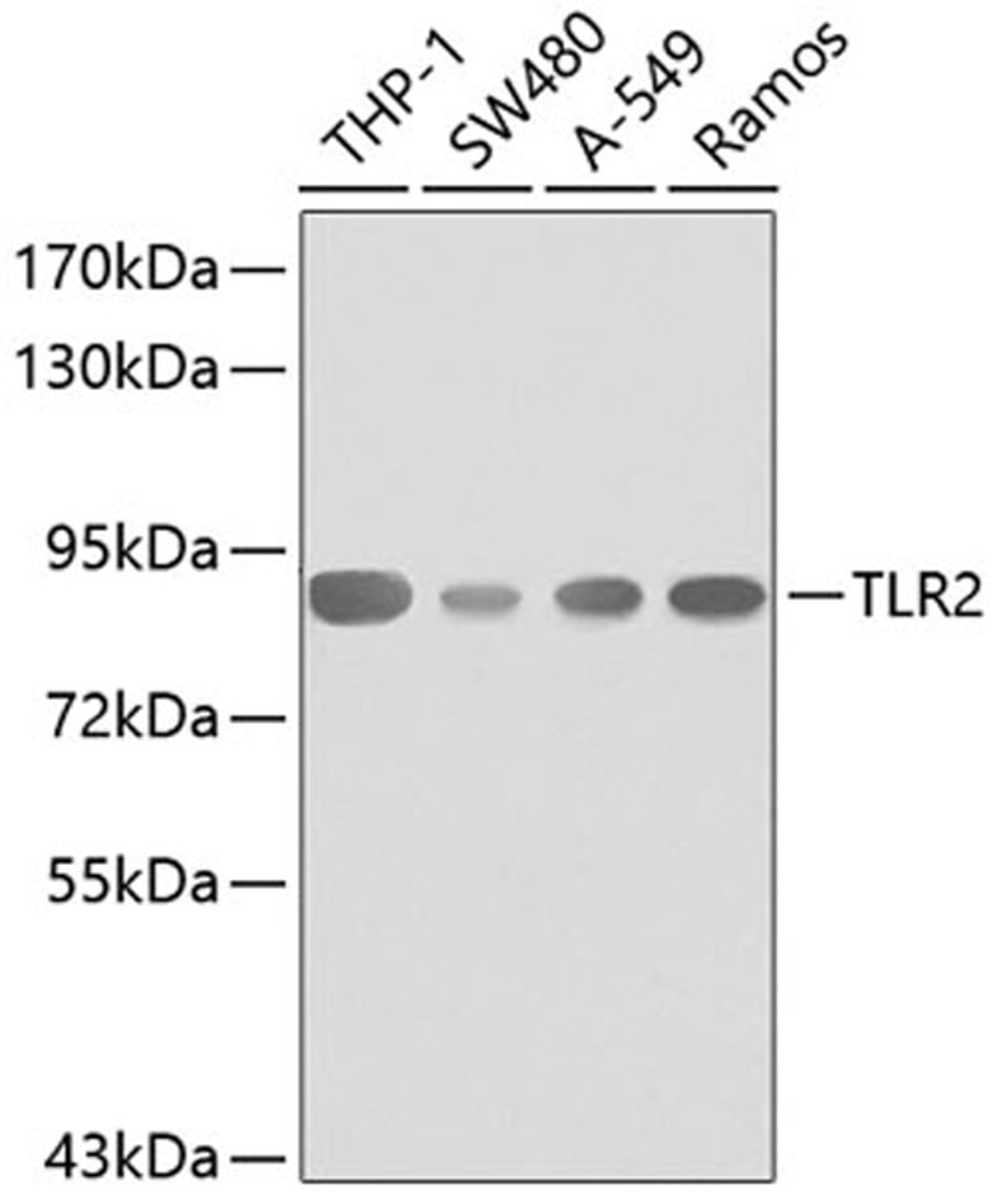 Western blot - TLR2 antibody (A0367)