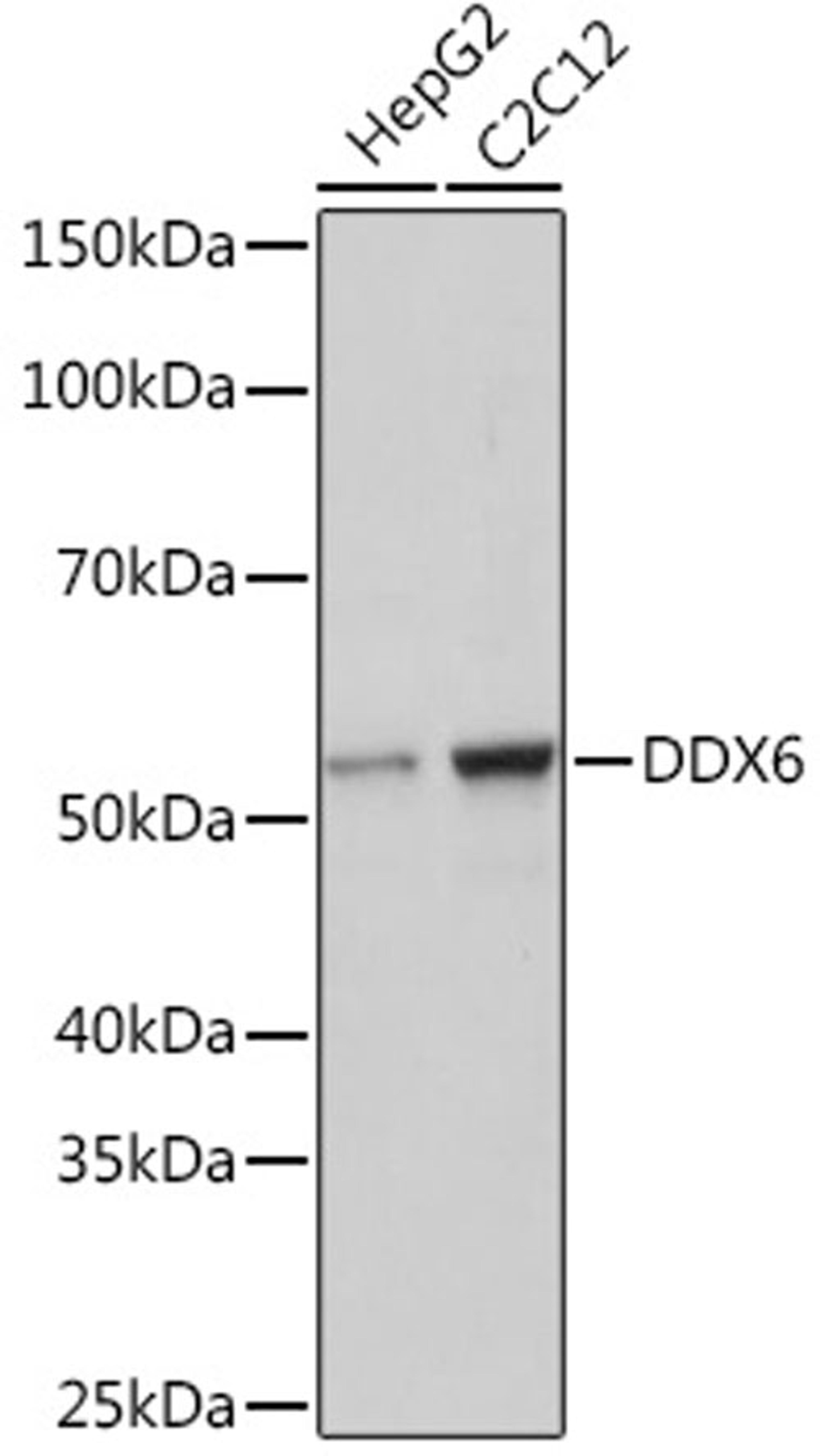 Western blot - DDX6 Rabbit mAb (A9634)