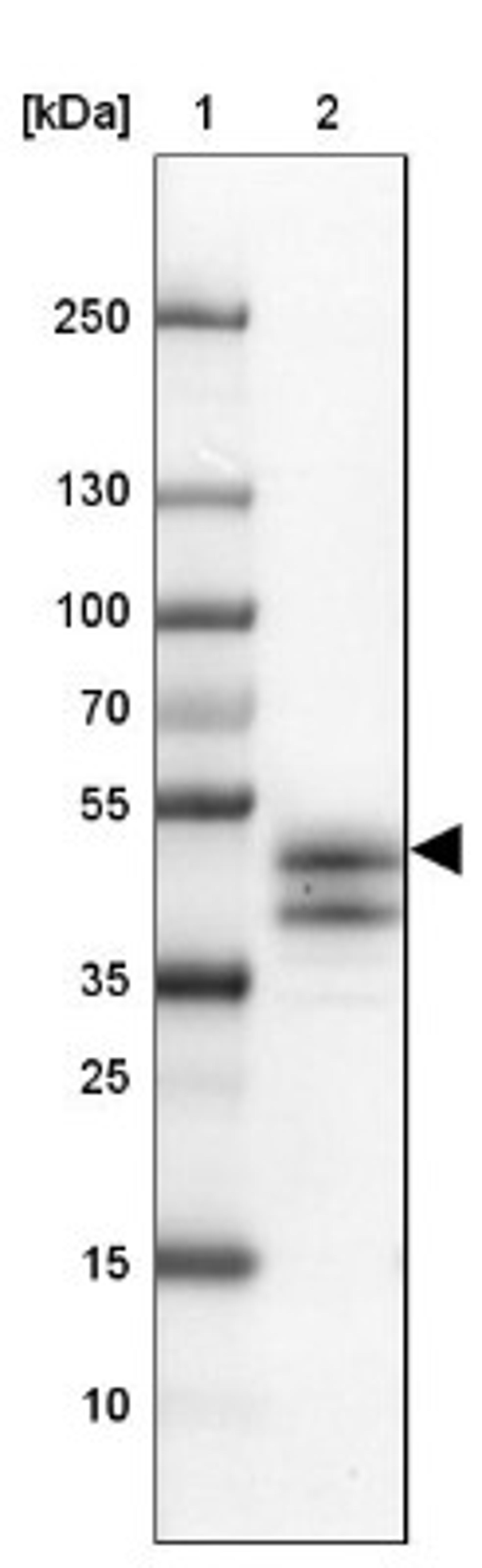 Western Blot: Intra Acrosomal Protein Antibody [NBP2-34054] - Lane 1: Marker [kDa] 250, 130, 100, 70, 55, 35, 25, 15, 10<br/>Lane 2: Testis