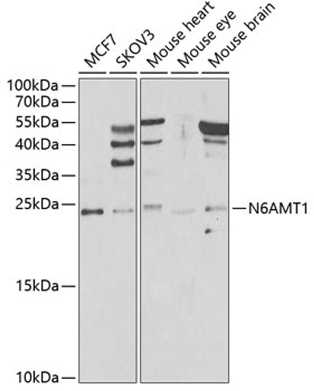 Western blot - N6AMT1 antibody (A7201)