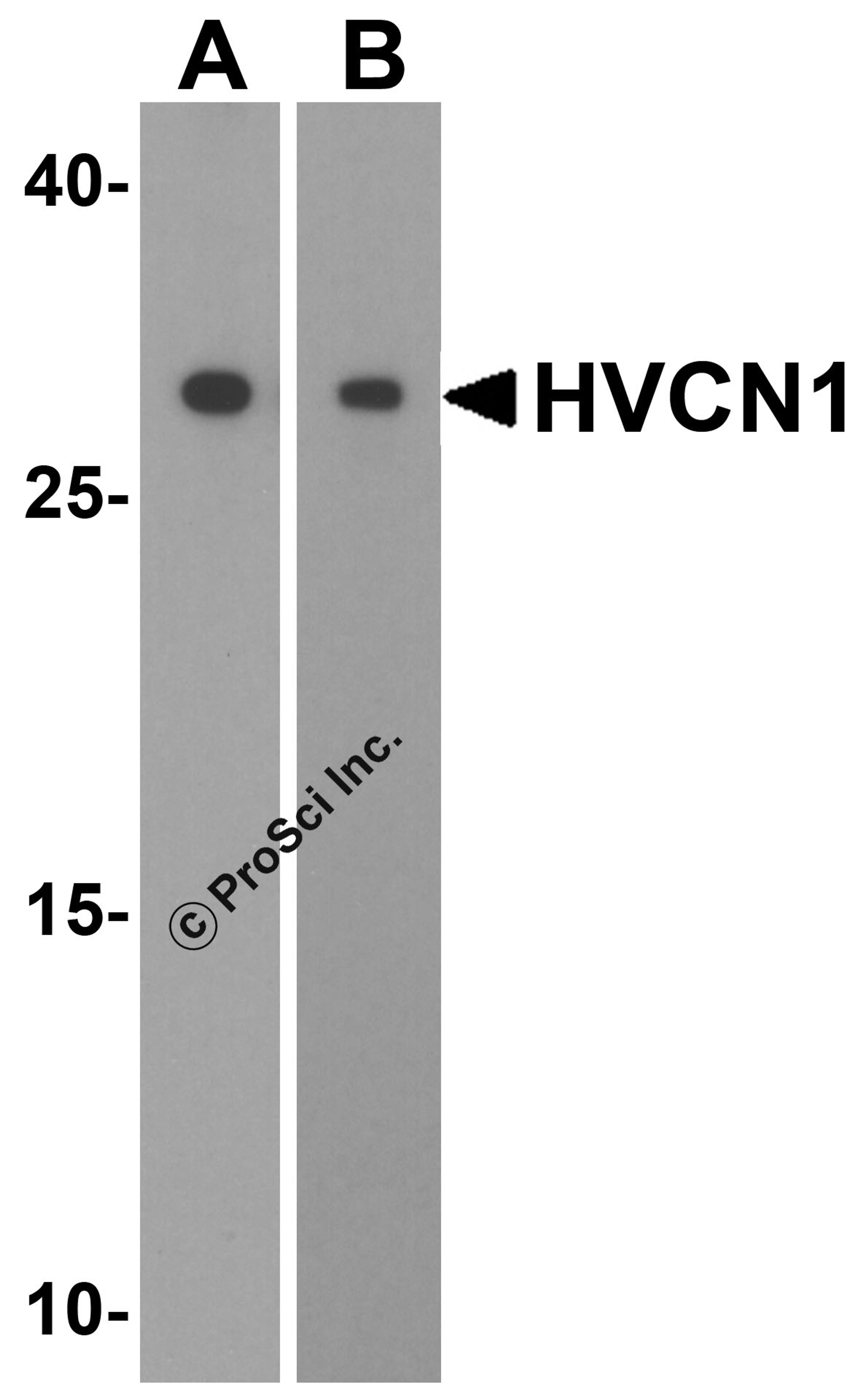 Western blot analysis of HVCN1 in (A) human spleen and (B) mouse spleen tissue lysates with HVCN1 antibody at 1 μg/mL.