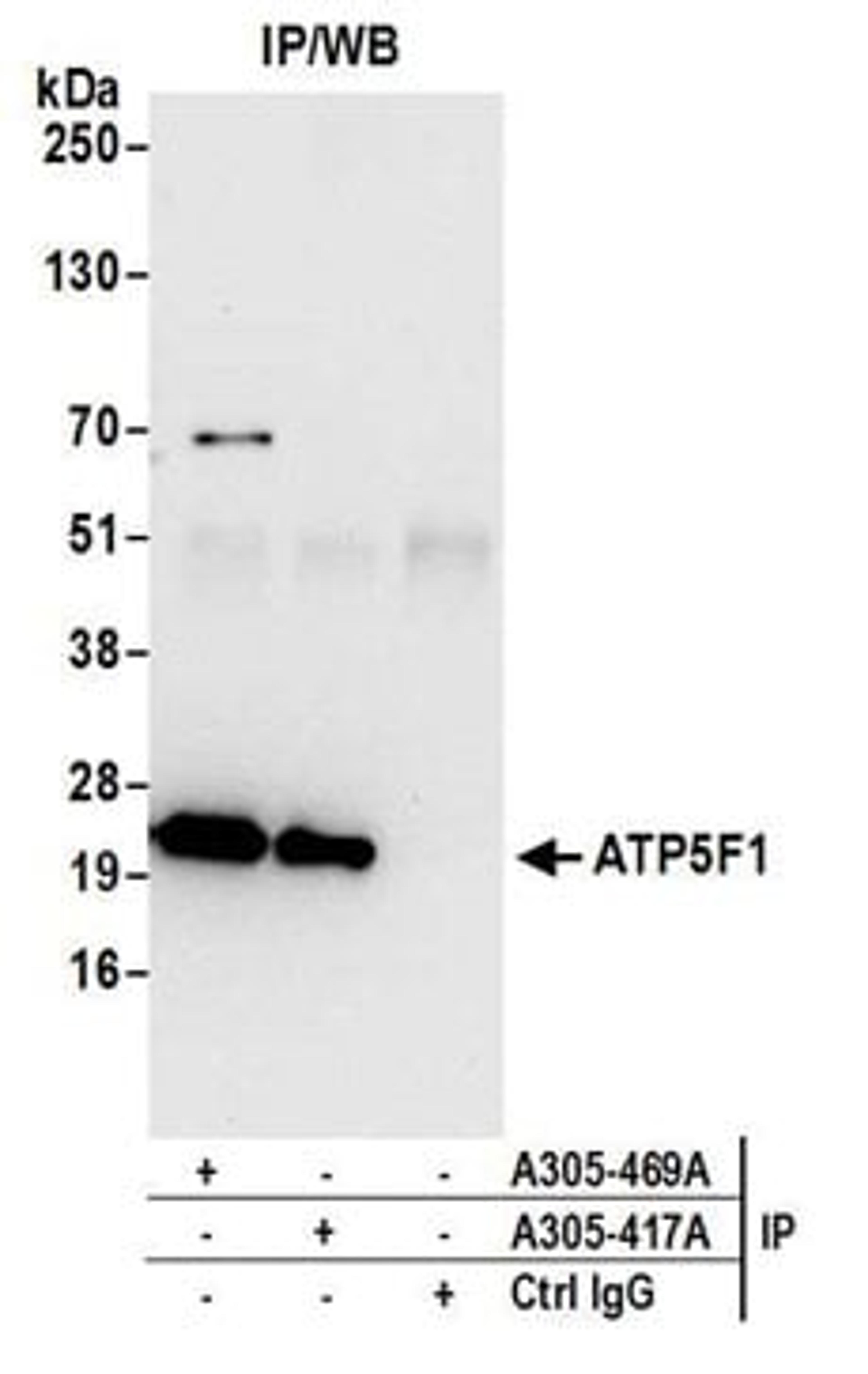 Detection of human ATP5F1 by western blot of immunoprecipitates.