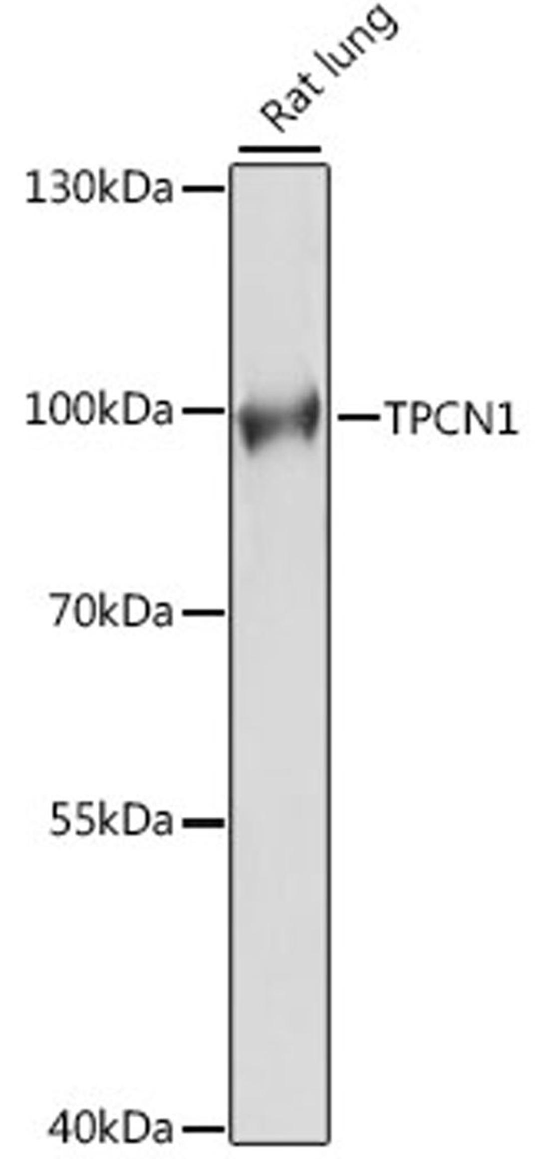 Western blot - TPCN1 antibody (A15847)