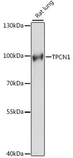 Western blot - TPCN1 antibody (A15847)