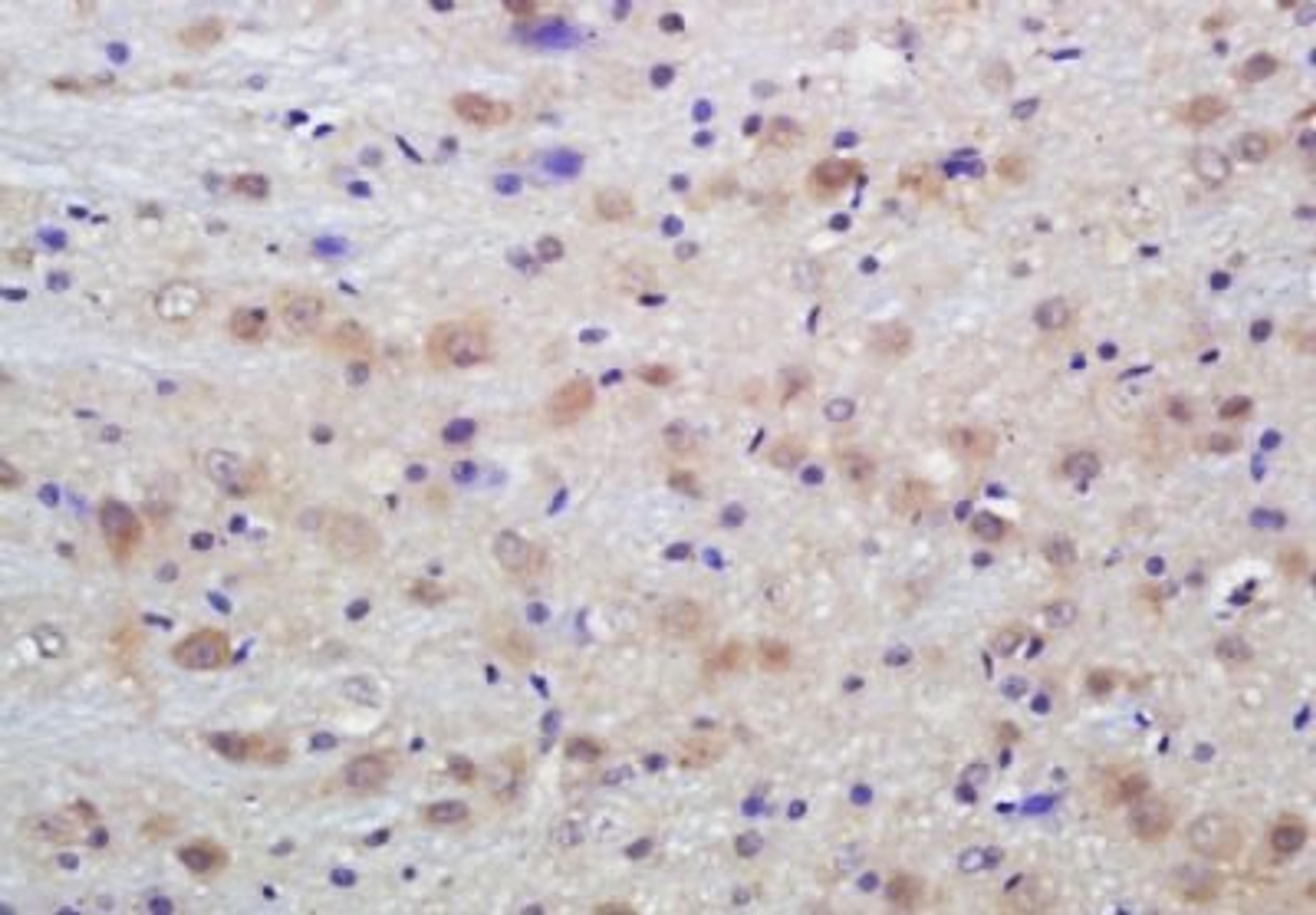 Immunohistochemical analysis of formalin-fixed paraffin embedded rat brain tissue using Dab1 (Phospho-Tyr198) antibody (dilution at 1:200)