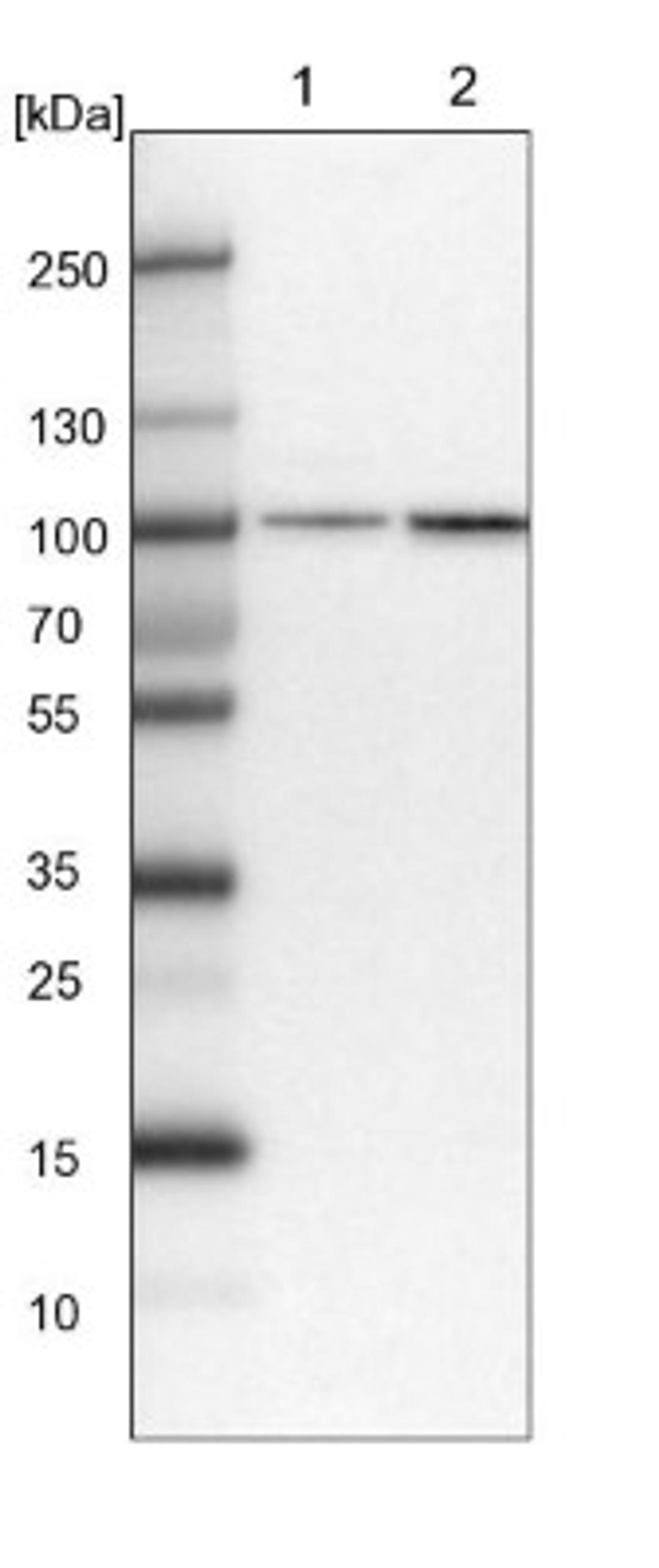 Western Blot: PLEKHM3 Antibody [NBP1-94090] - Lane 1: NIH-3T3 cell lysate (Mouse embryonic fibroblast cells)<br/>Lane 2: NBT-II cell lysate (Rat Wistar bladder tumour cells)