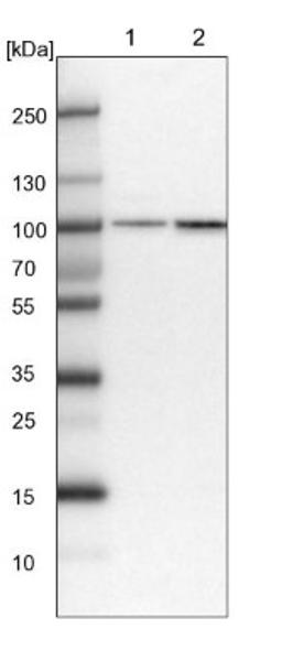 Western Blot: PLEKHM3 Antibody [NBP1-94090] - Lane 1: NIH-3T3 cell lysate (Mouse embryonic fibroblast cells)<br/>Lane 2: NBT-II cell lysate (Rat Wistar bladder tumour cells)