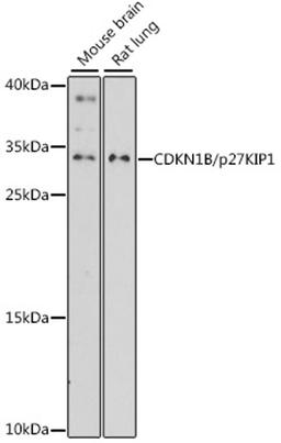 Western blot - CDKN1B/p27KIP1 antibody (A15632)