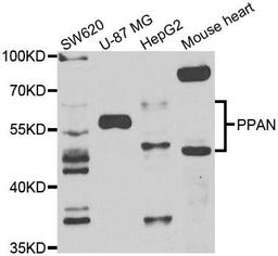 Western blot analysis of extracts of various cell lines using PPAN antibody