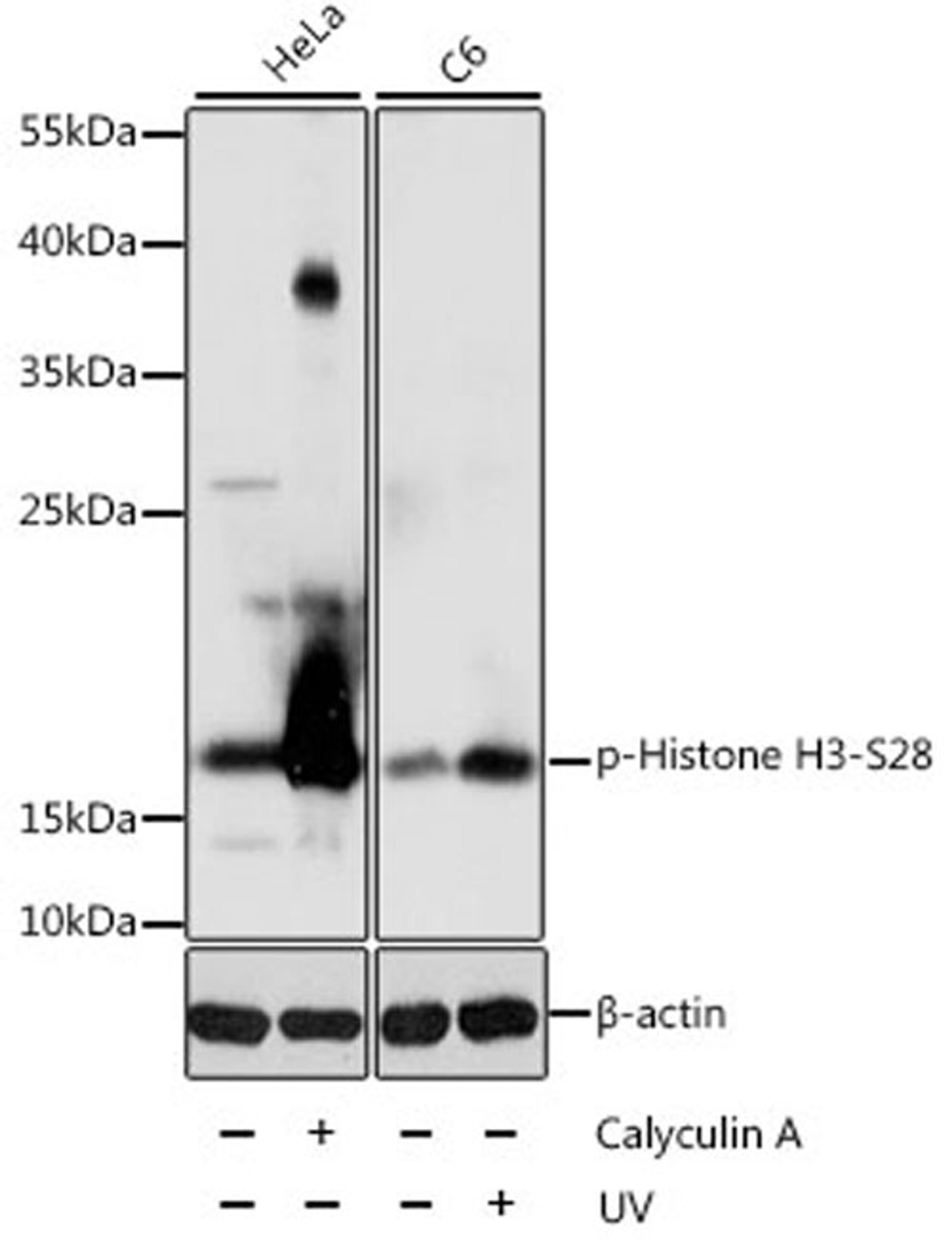 Western blot - Phospho-Histone H3-S28 antibody (AP0097)