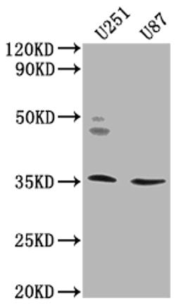 Western Blot. Positive WB detected in: U251 whole cell lysate, U87 whole cell lysate. All lanes: OR5K2 antibody at 1:2000. Secondary. Goat polyclonal to rabbit IgG at 1/50000 dilution. Predicted band size: 36 kDa. Observed band size: 36 kDa.