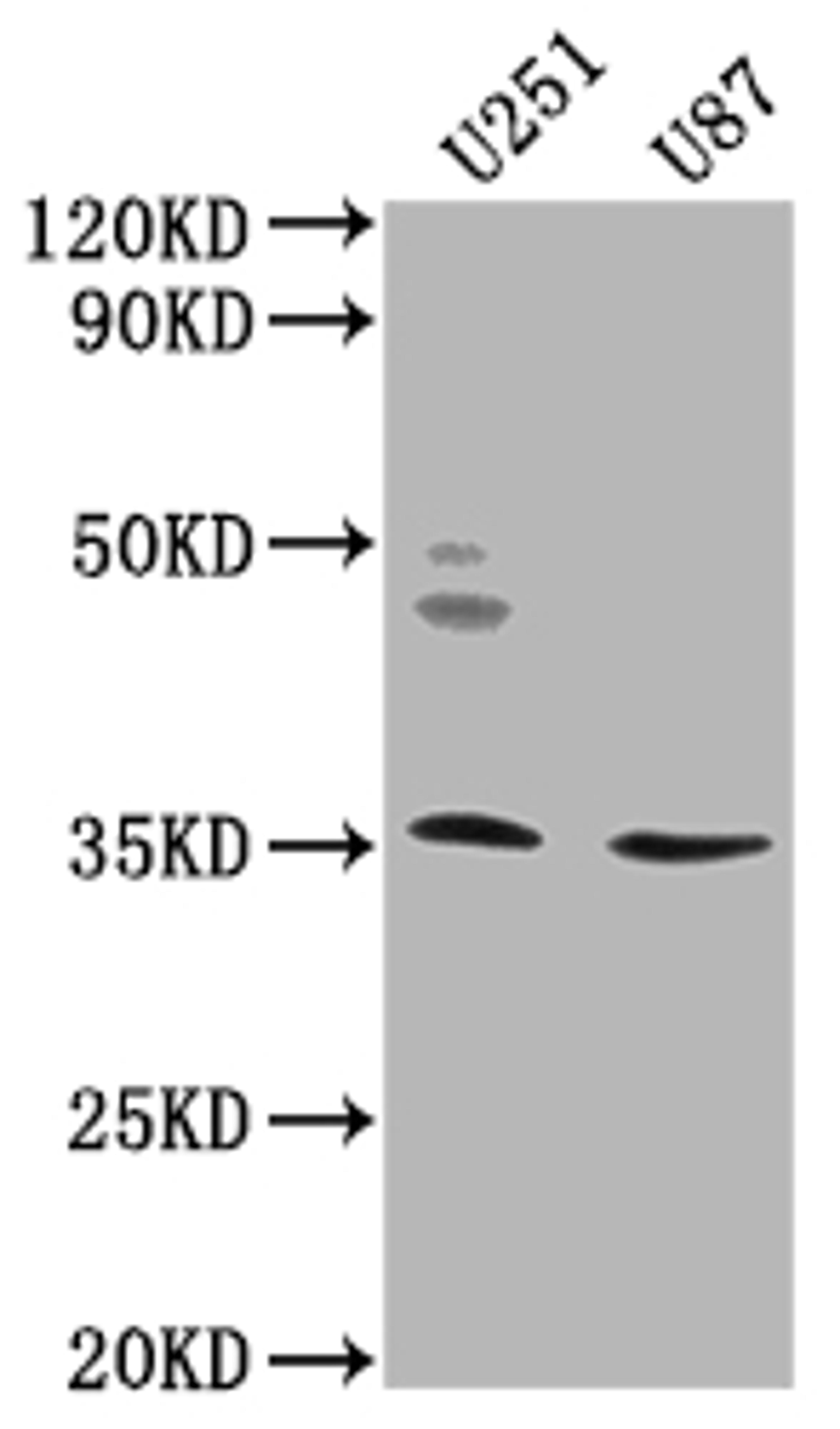 Western Blot. Positive WB detected in: U251 whole cell lysate, U87 whole cell lysate. All lanes: OR5K2 antibody at 1:2000. Secondary. Goat polyclonal to rabbit IgG at 1/50000 dilution. Predicted band size: 36 kDa. Observed band size: 36 kDa.