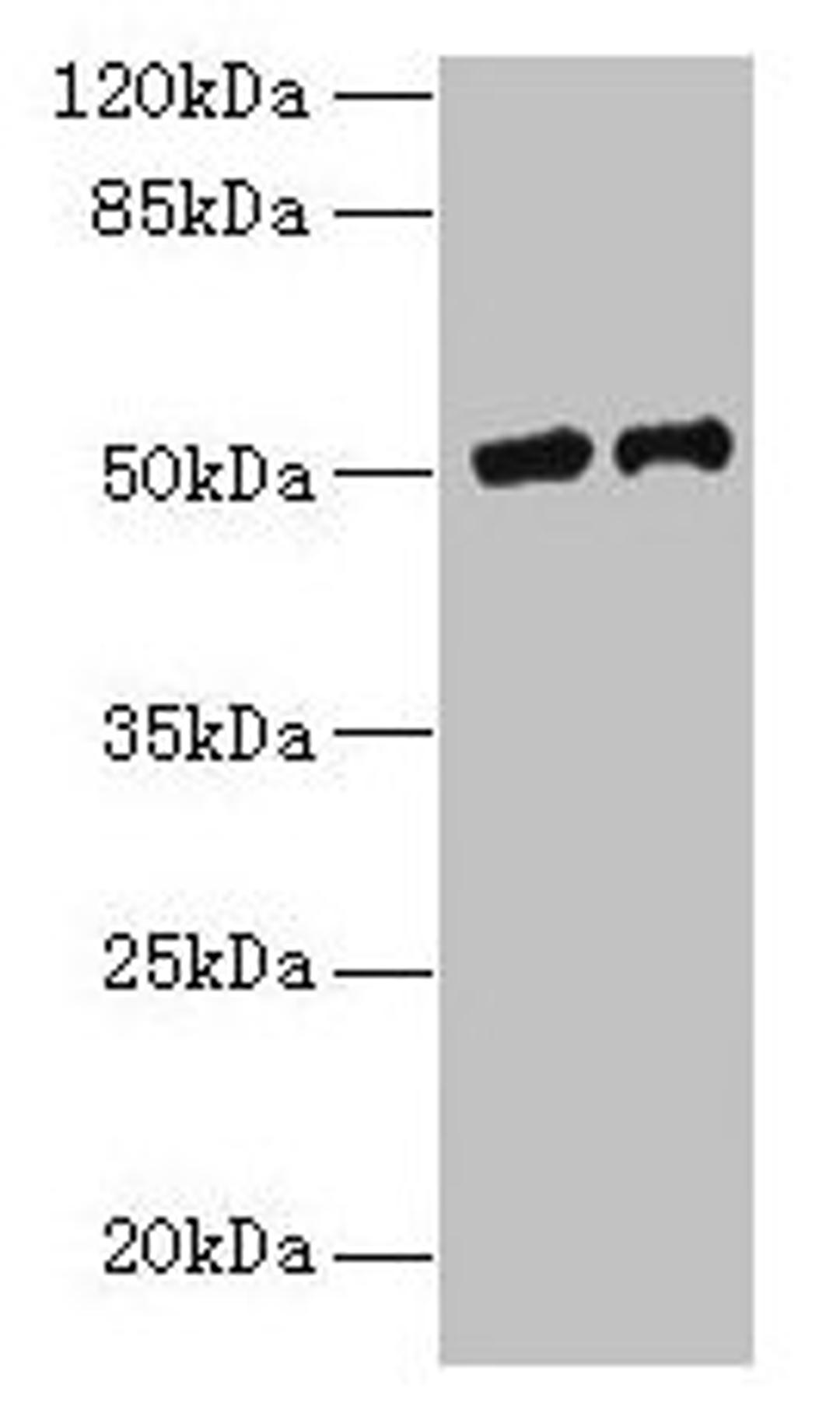 Western blot. All lanes: PLA2G7 antibody at 9µg/ml. Lane 1: RAW264.7 whole cell lysate. Lane 2: Mouse liver tissue. Secondary. Goat polyclonal to rabbit IgG at 1/10000 dilution. Predicted band size: 51 kDa. Observed band size: 51 kDa