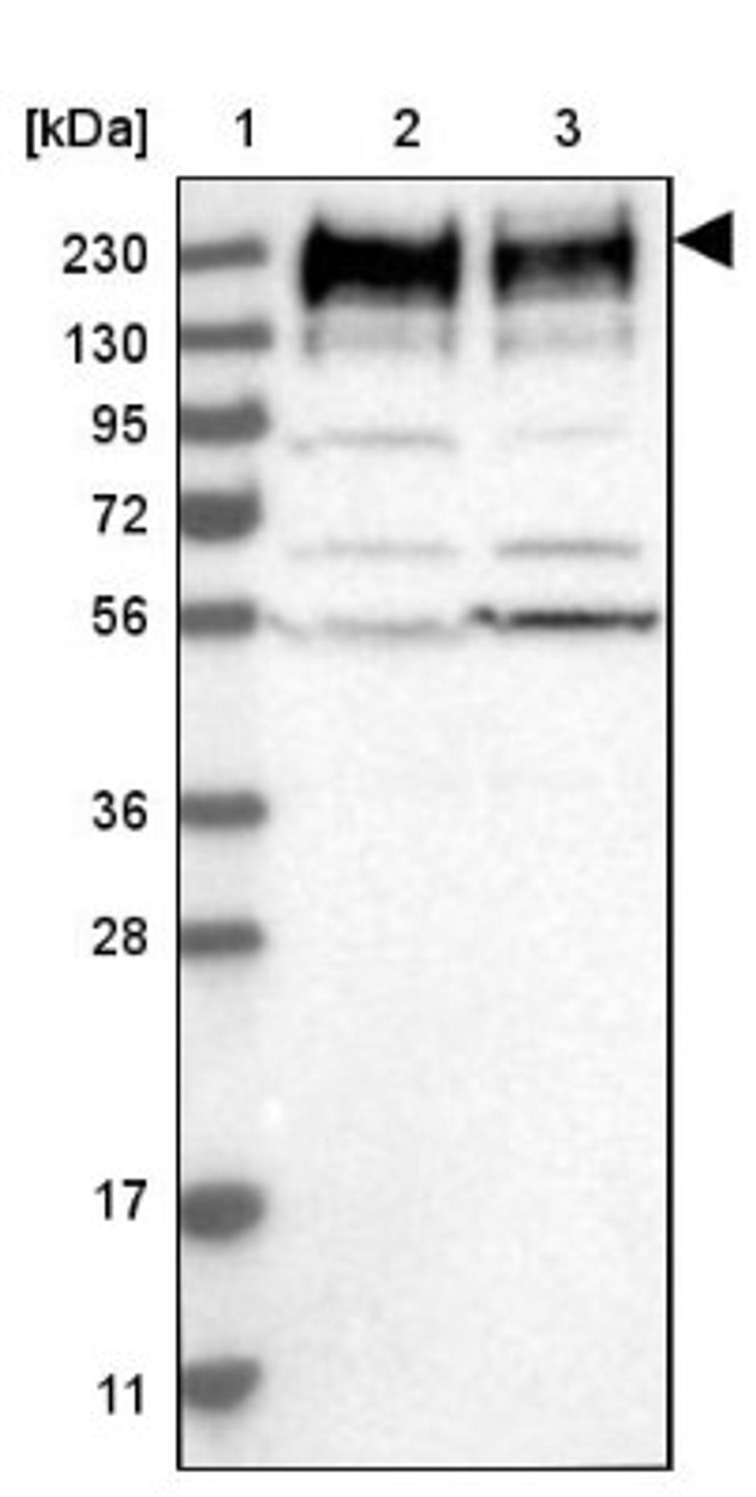 Western Blot: SON Antibody [NBP1-88706] - Lane 1: Marker [kDa] 230, 130, 95, 72, 56, 36, 28, 17, 11<br/>Lane 2: Human cell line RT-4<br/>Lane 3: Human cell line U-251MG sp