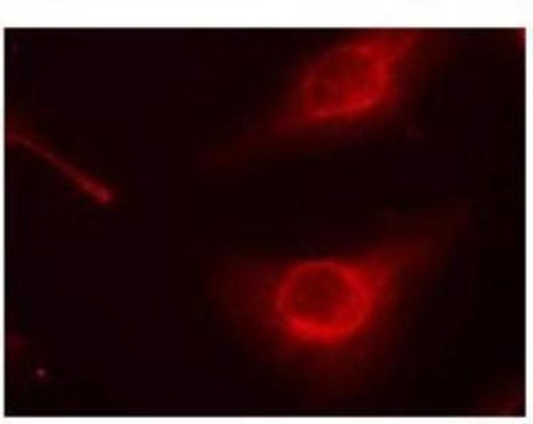 Immunocytochemistry/Immunofluorescence: Cofilin [p Ser3] Antibody [NB100-81865] - Immunfluorescence staining of methanol-fixed Hela cells using cofilin (p Ser3) antibody.