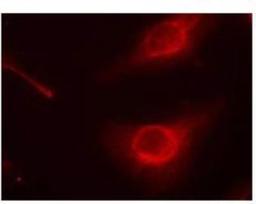 Immunocytochemistry/Immunofluorescence: Cofilin [p Ser3] Antibody [NB100-81865] - Immunfluorescence staining of methanol-fixed Hela cells using cofilin (p Ser3) antibody.