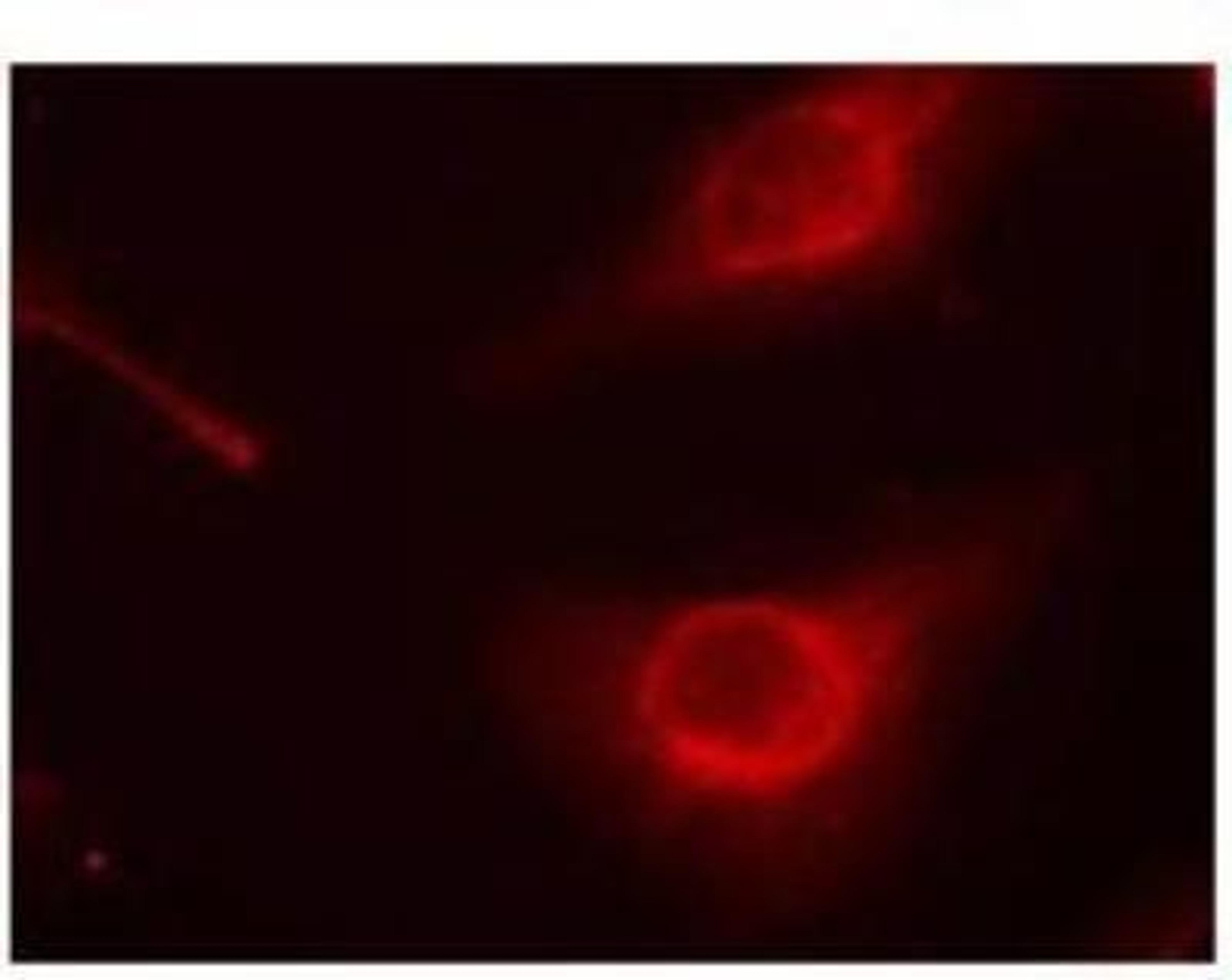 Immunocytochemistry/Immunofluorescence: Cofilin [p Ser3] Antibody [NB100-81865] - Immunfluorescence staining of methanol-fixed Hela cells using cofilin (p Ser3) antibody.