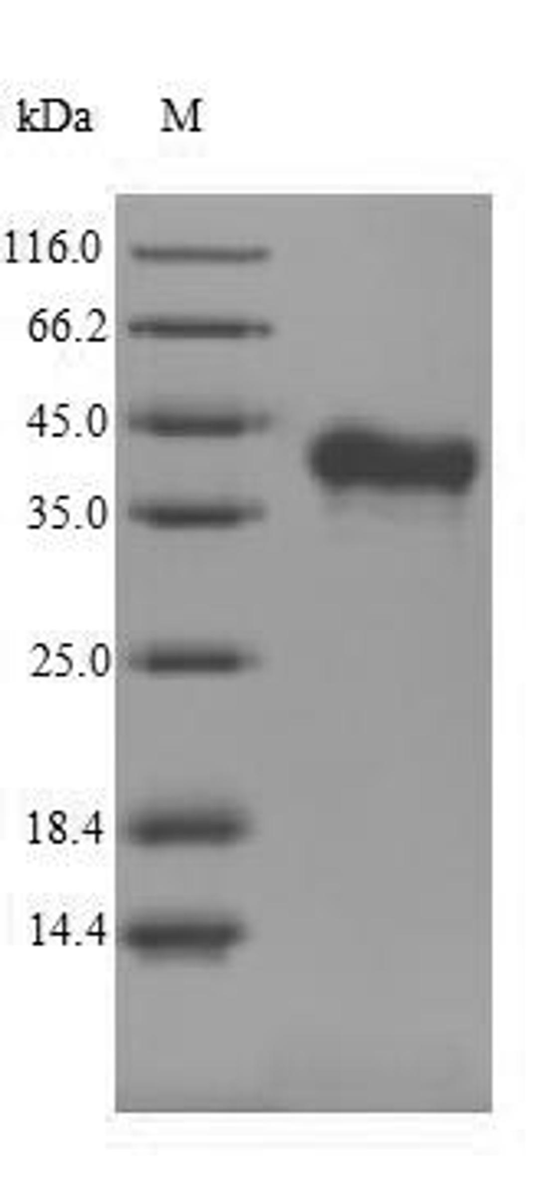 (Tris-Glycine gel) Discontinuous SDS-PAGE (reduced) with 5% enrichment gel and 15% separation gel.