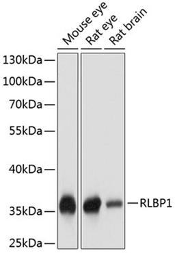 Western blot - RLBP1 antibody (A9094)