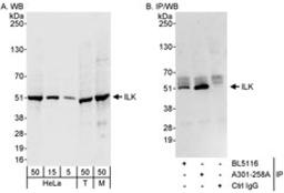 Detection of human and mouse ILK by western blot (h&m) and immunoprecipitation (h).