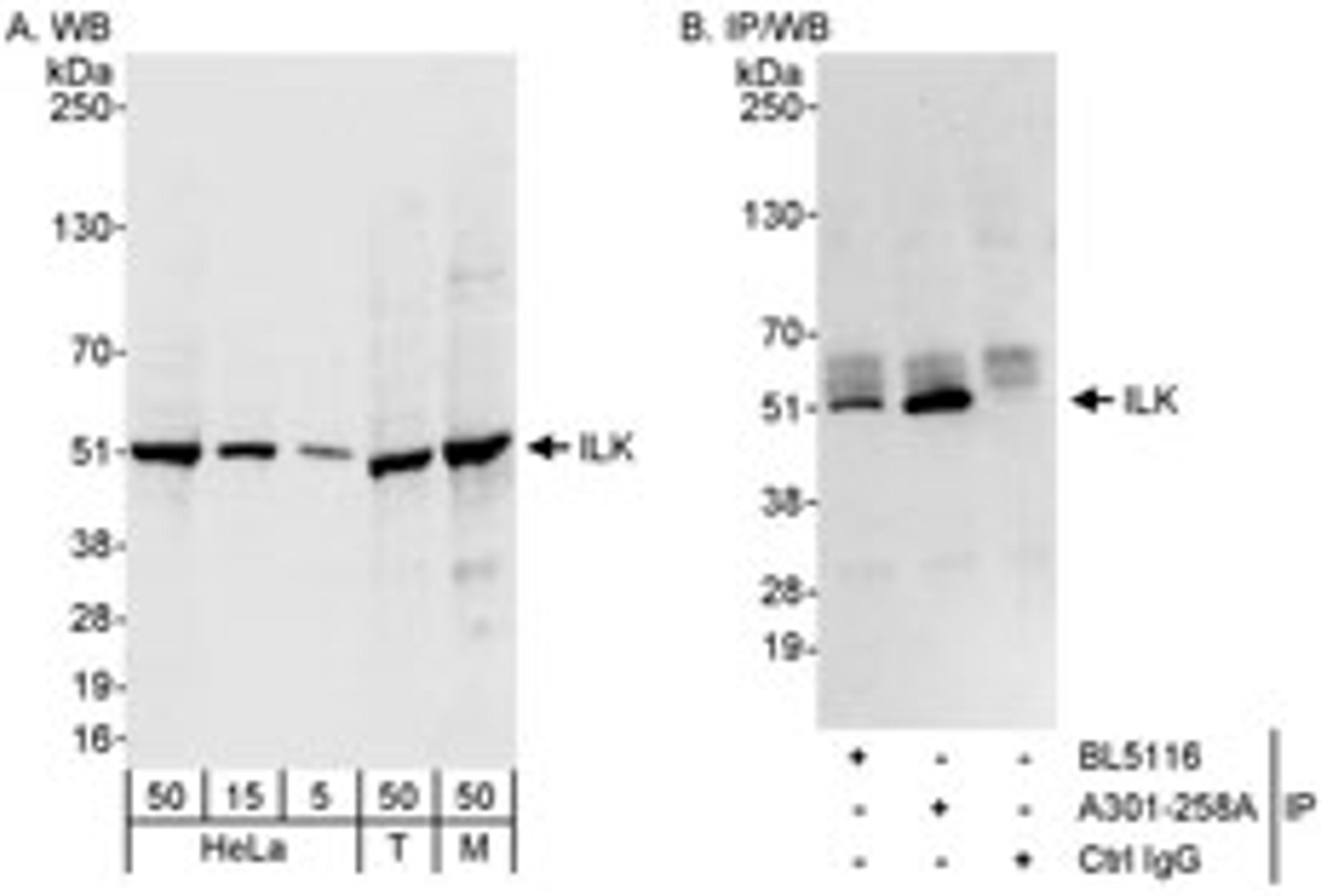 Detection of human and mouse ILK by western blot (h&m) and immunoprecipitation (h).