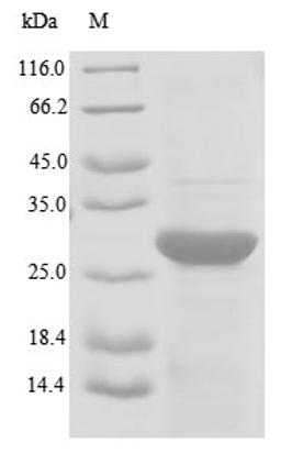 (Tris-Glycine gel) Discontinuous SDS-PAGE (reduced) with 5% enrichment gel and 15% separation gel.