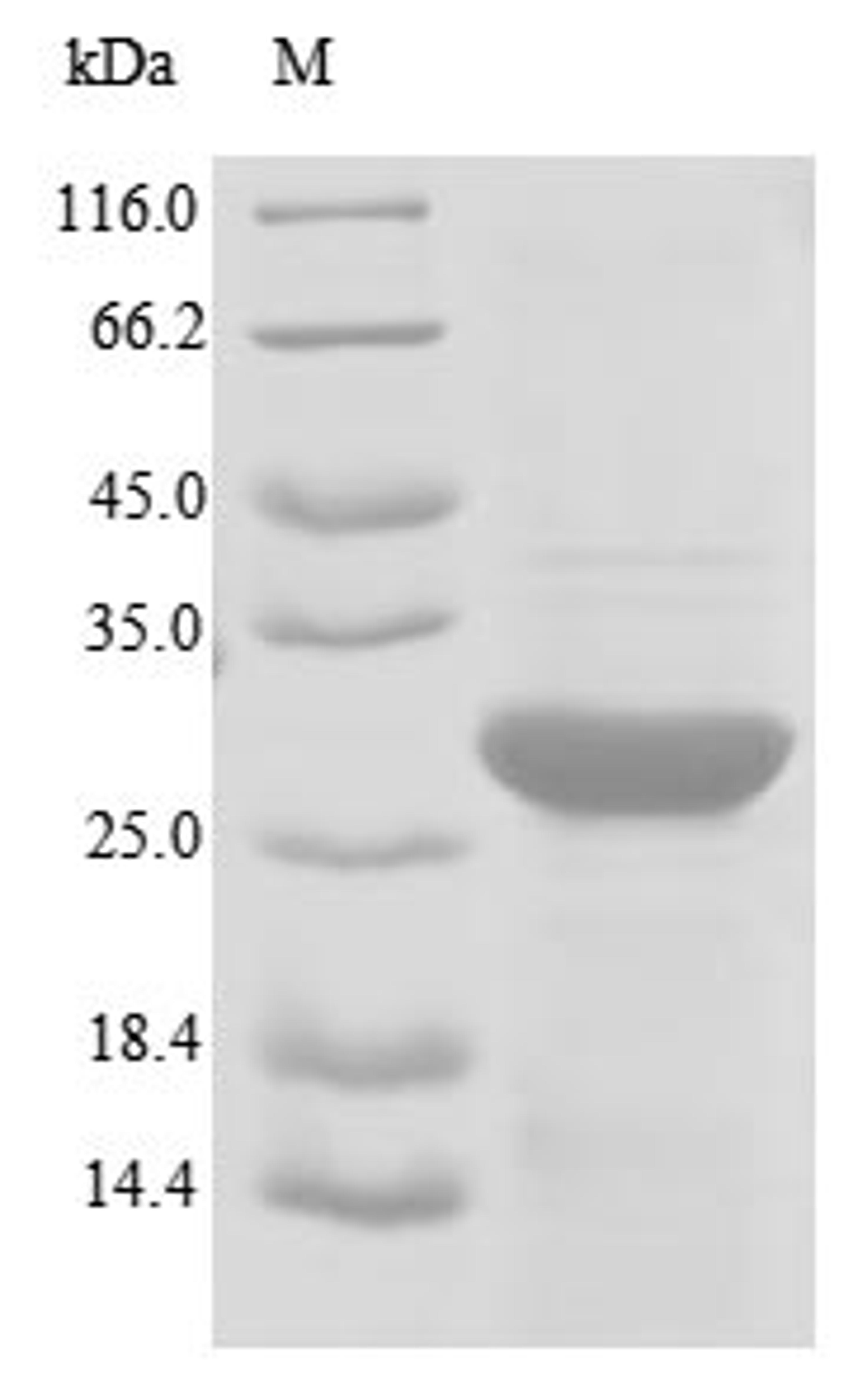 (Tris-Glycine gel) Discontinuous SDS-PAGE (reduced) with 5% enrichment gel and 15% separation gel.