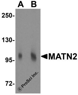 Western blot analysis of MATN2 in 3T3 cell lysate with MATN2 antibody at (A) 1 and (B) 2 &#956;g/mL.