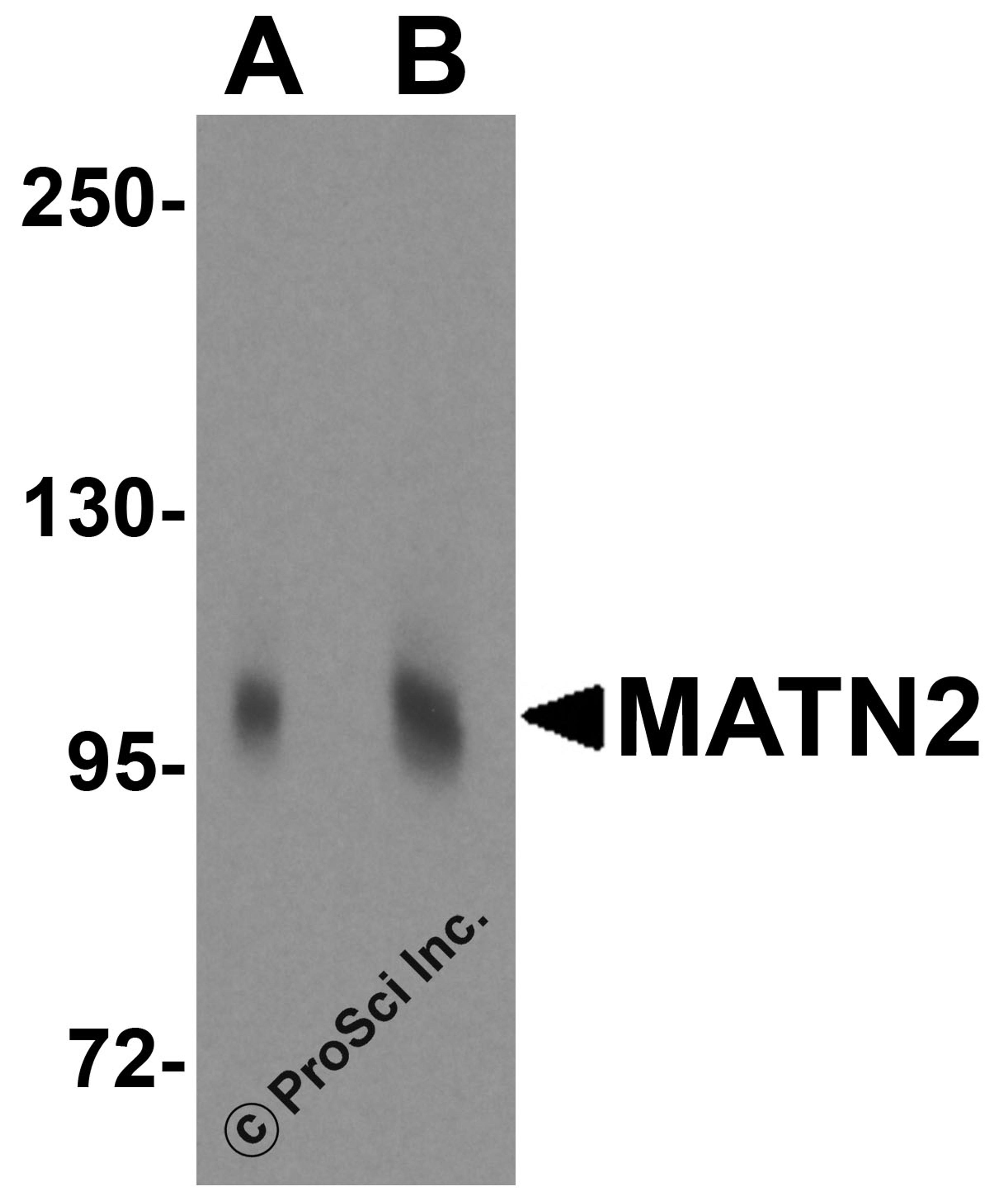 Western blot analysis of MATN2 in 3T3 cell lysate with MATN2 antibody at (A) 1 and (B) 2 μg/mL.