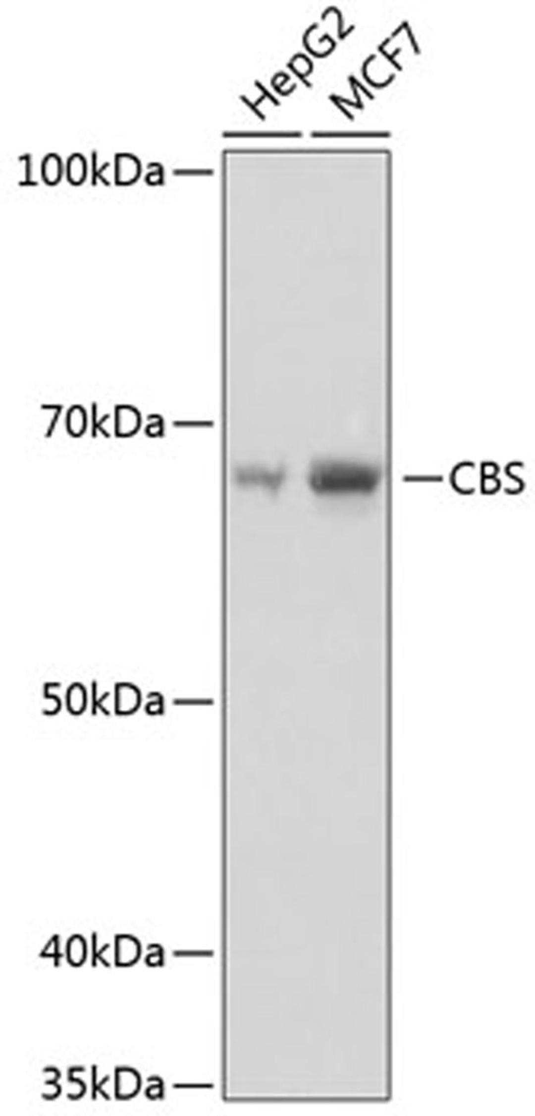 Western blot - CBS Rabbit mAb (A11612)