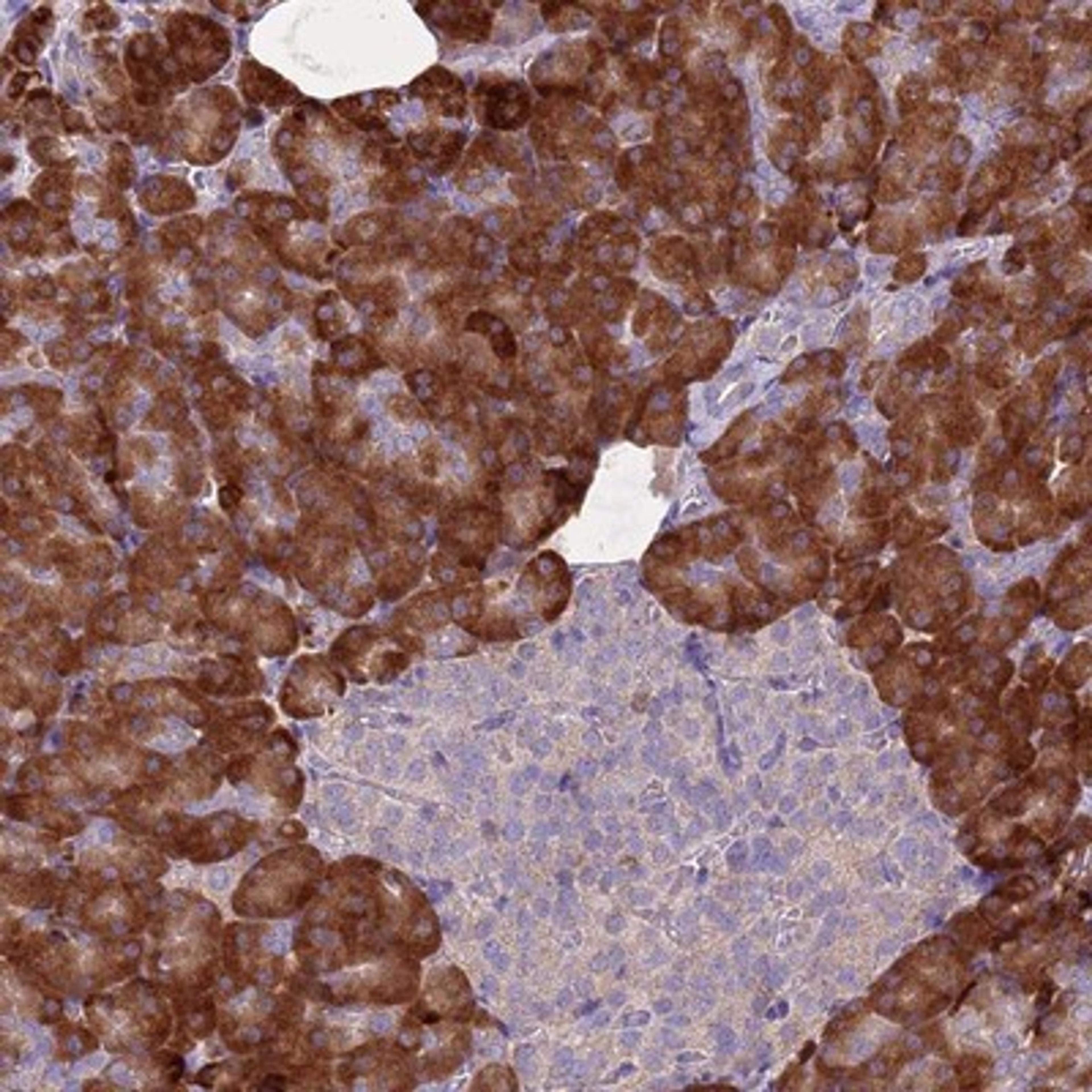 Immunohistochemistry-Paraffin: BZW1 Antibody [NBP2-14369] Staining of human pancreas shows strong cytoplasmic positivity in exocrine glandular cells.