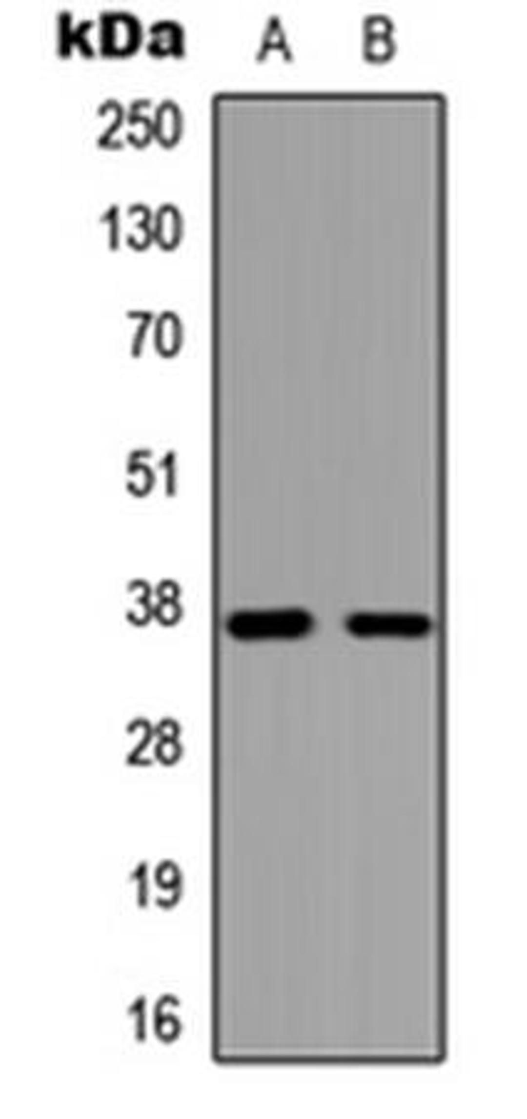 Western blot analysis of HeLa (Lane1), COLO205 (Lane2) whole cell using GPR119 antibody