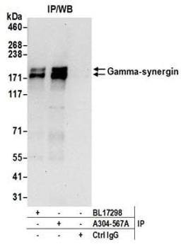 Detection of human Gamma-synergin by western blot of immunoprecipitates.