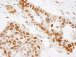 Detection of human BAAT1 by immunohistochemistry.