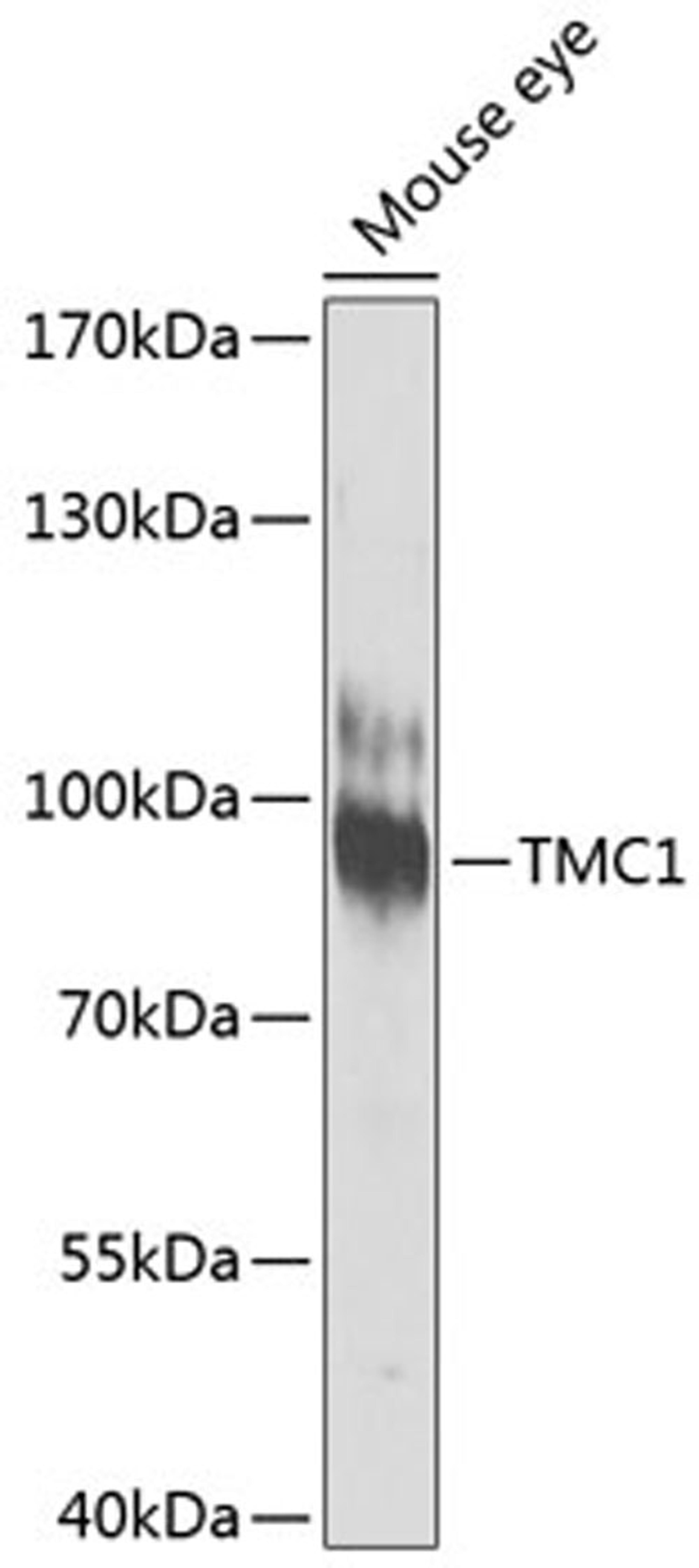 Western blot - TMC1 antibody (A8595)