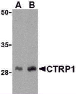 Western blot analysis of CTRP1 in human kidney cell lysate with CTRP1 antibody at (A) 1 and (B) 2 &#956;g/mL.