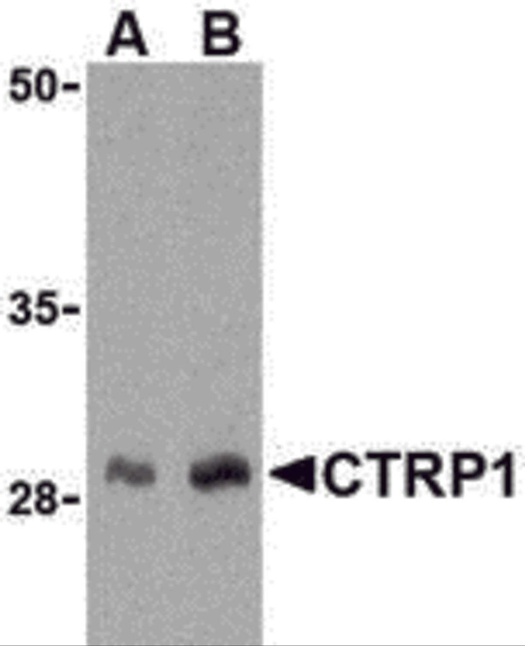 Western blot analysis of CTRP1 in human kidney cell lysate with CTRP1 antibody at (A) 1 and (B) 2 μg/mL.