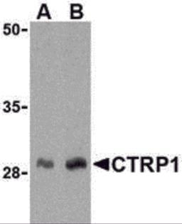 Western blot analysis of CTRP1 in human kidney cell lysate with CTRP1 antibody at (A) 1 and (B) 2 μg/mL.