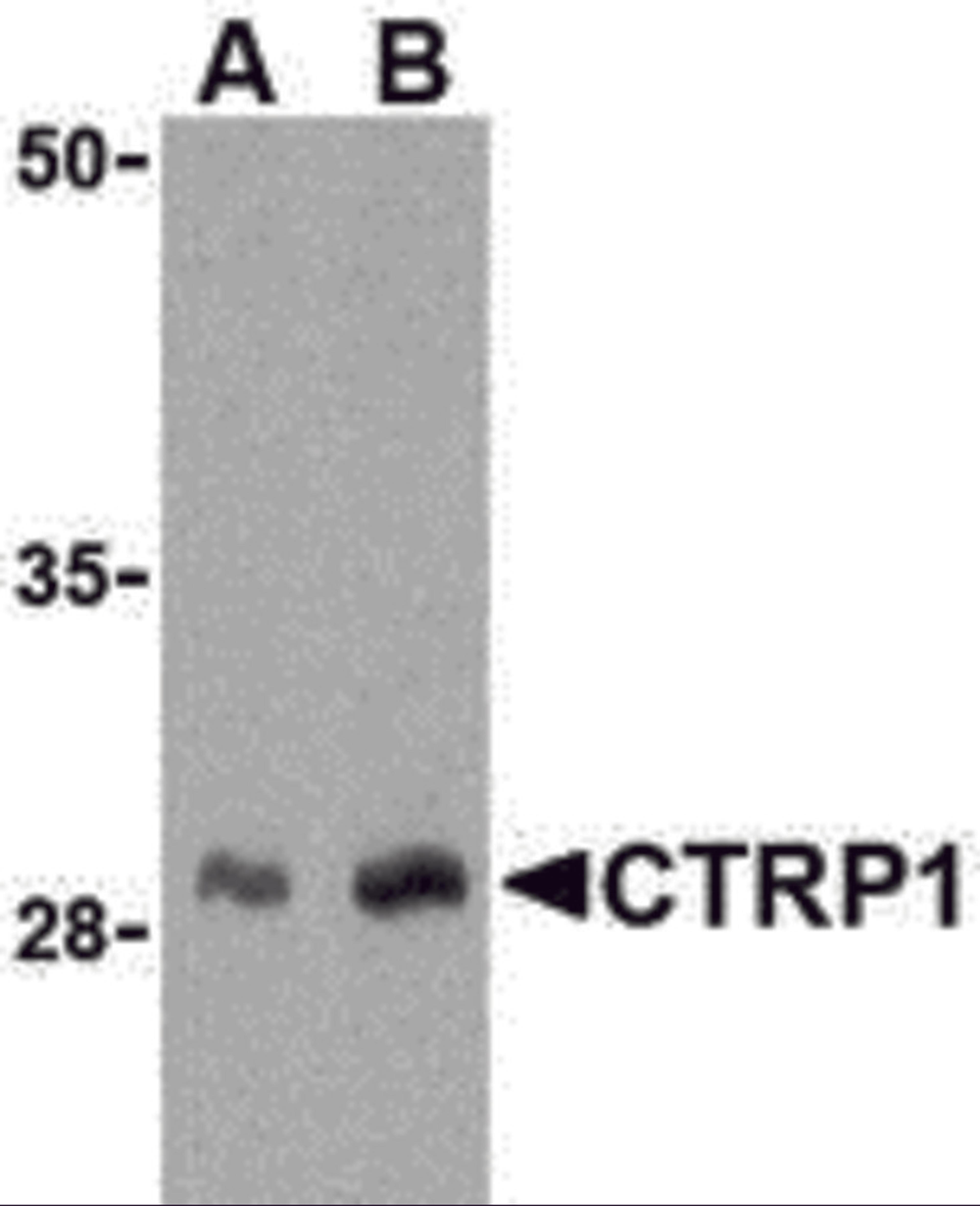 Western blot analysis of CTRP1 in human kidney cell lysate with CTRP1 antibody at (A) 1 and (B) 2 μg/mL.